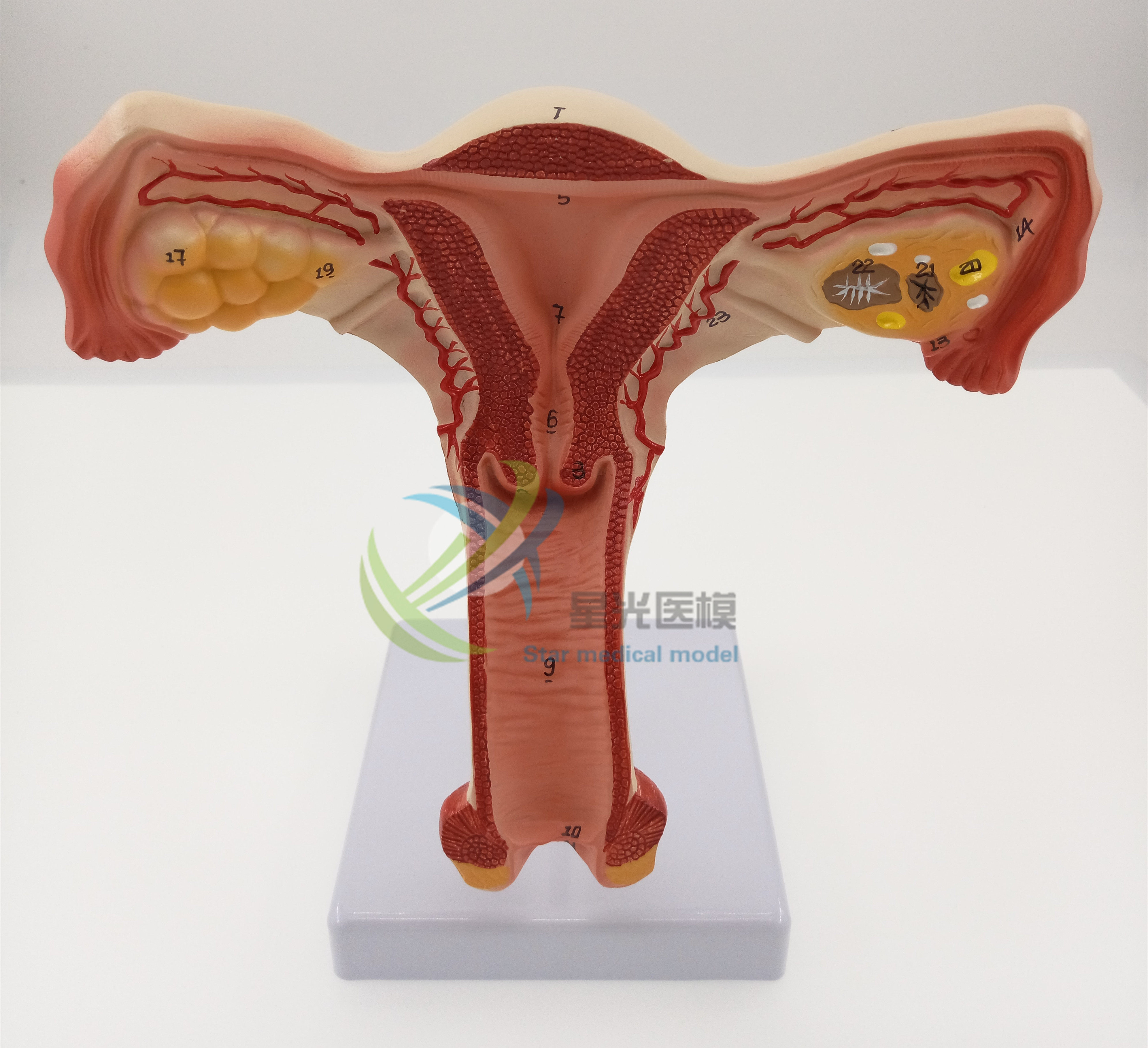 星光医模新款子宫模型数字标注教学仿真高端女性内生殖系统标本