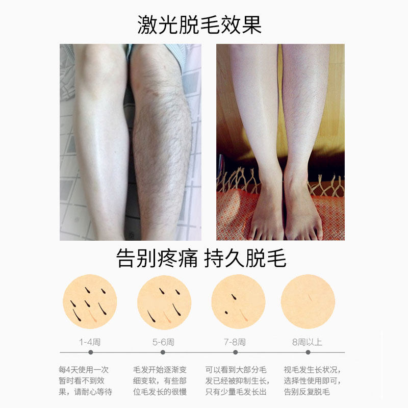 维娜丝激光脱毛仪全身冰点无痛脱毛仪器家用私处脱毛久永脱毛机器