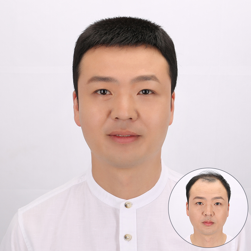 补发假发男士头顶片真发无痕隐形前额整顶假发