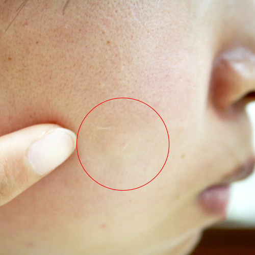 日本直邮白色小町脸部痘痘遮盖贴痘印遮挡遮细皱纹美容防晒贴16个