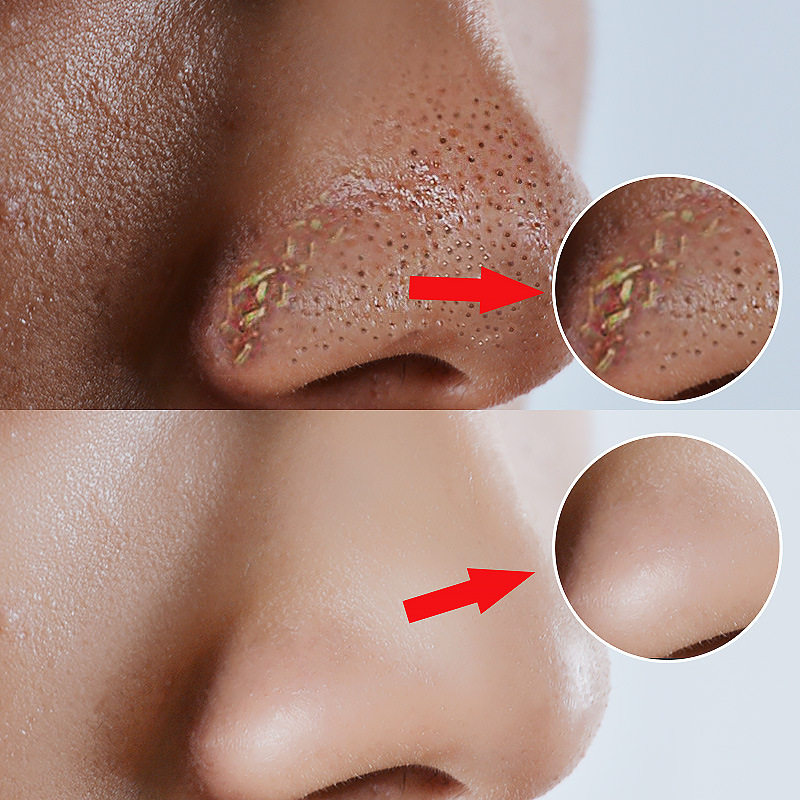 比芭美泰国去黑头撕拉面膜收缩毛孔套装深层清洁其它彩妆