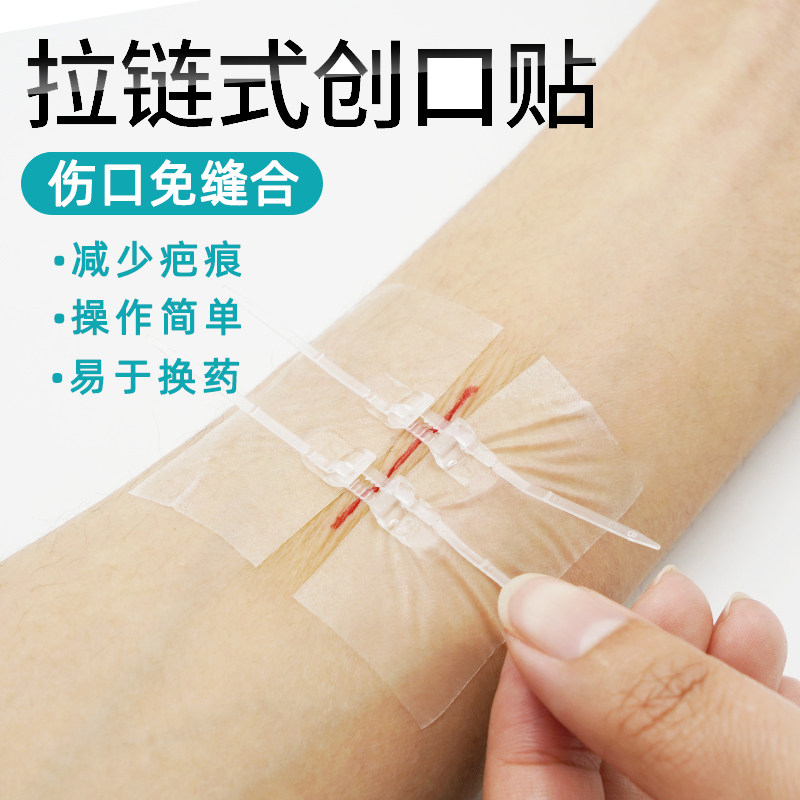 缝合张贴伤口皮肤胶带器免缝针减张贴拉创口伤口敷料