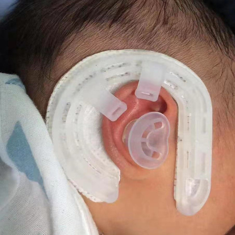 婴儿耳廓矫正宝宝耳朵纠正新生儿矫形塑形器耳耳套
