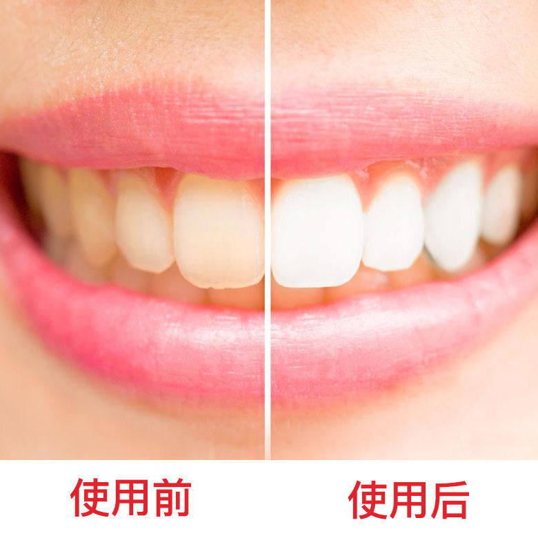 洗牙粉牙白人更美小苏打牙粉云南白药去牙结石去黄洗白黄牙神器