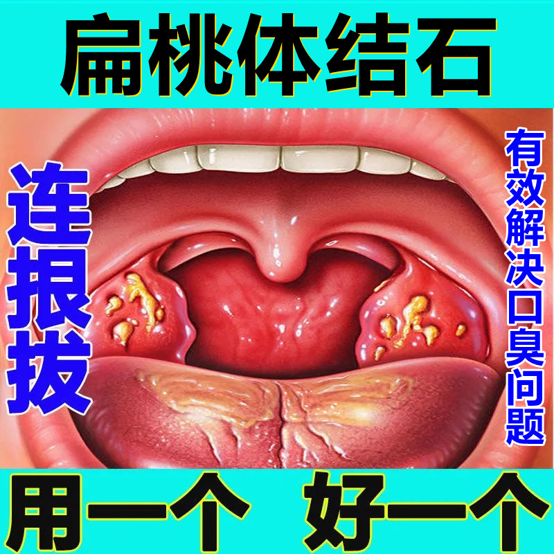 扁导体结实图片