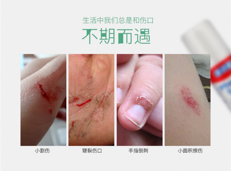德国sos液体创口创可贴防水透气伤口愈合凝胶户外应急装备