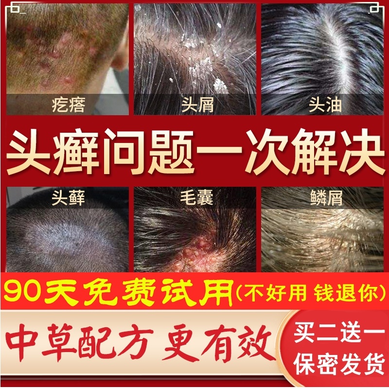 头癣治疗克星皮肤囊炎毛囊炎药膏洗发水中药头发动物保健品