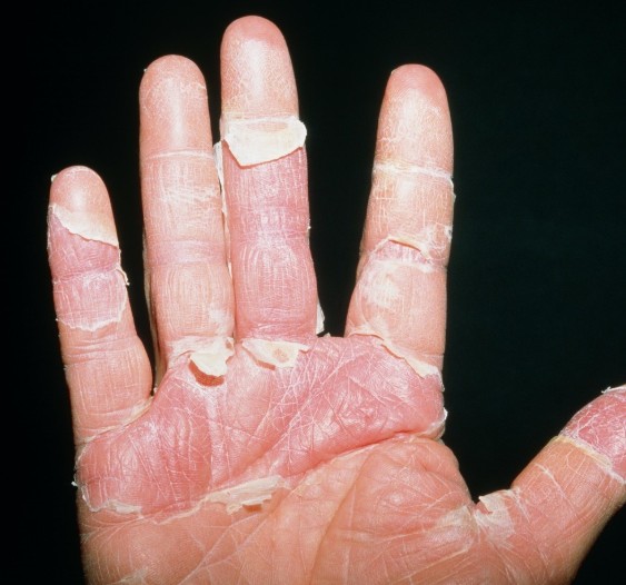 手脚脱皮膏起干燥手指足防干裂滋润保湿掉皮护手霜