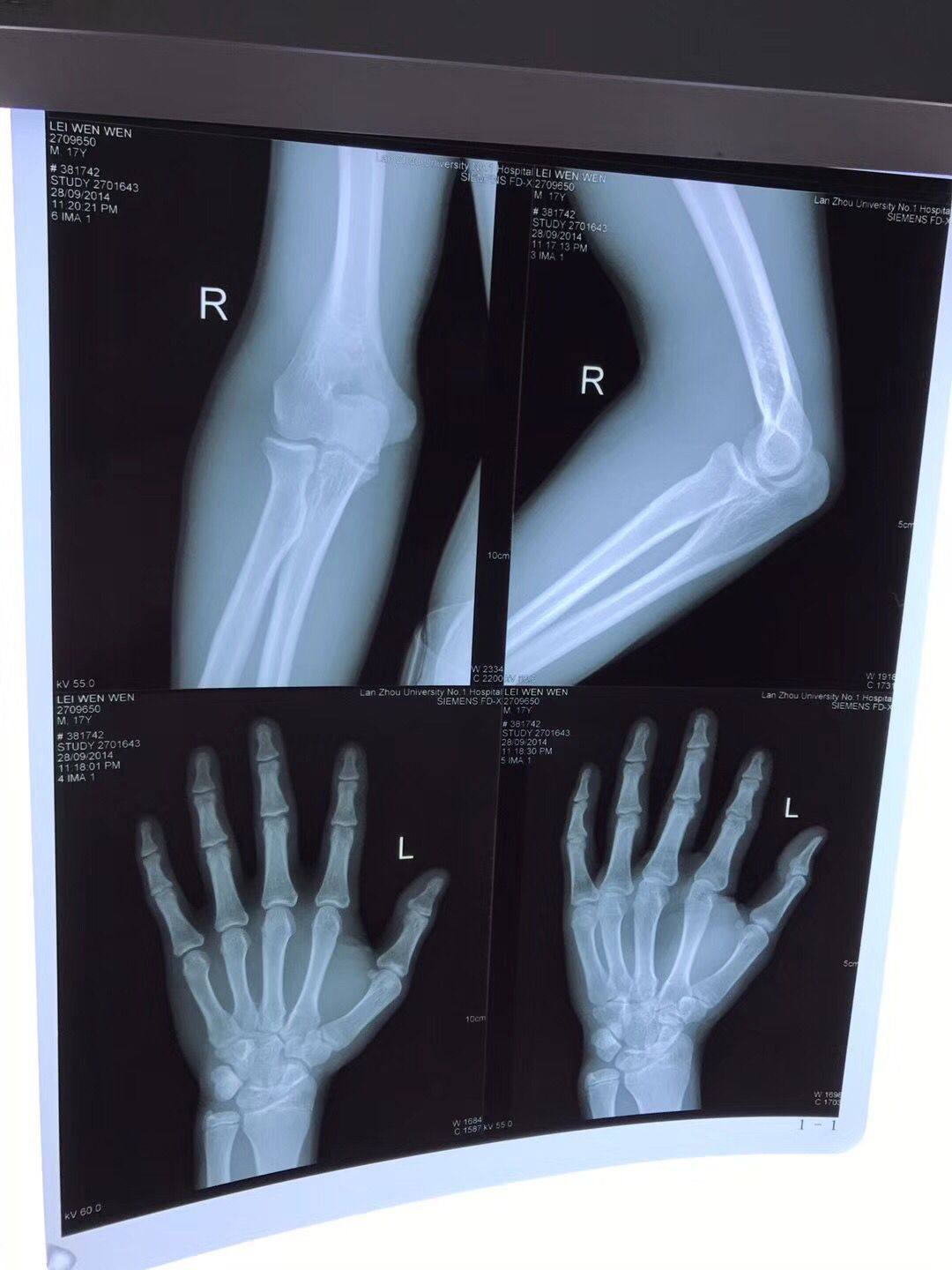 医用彩超光片drct胶片打印电影电视小品道具打印纸