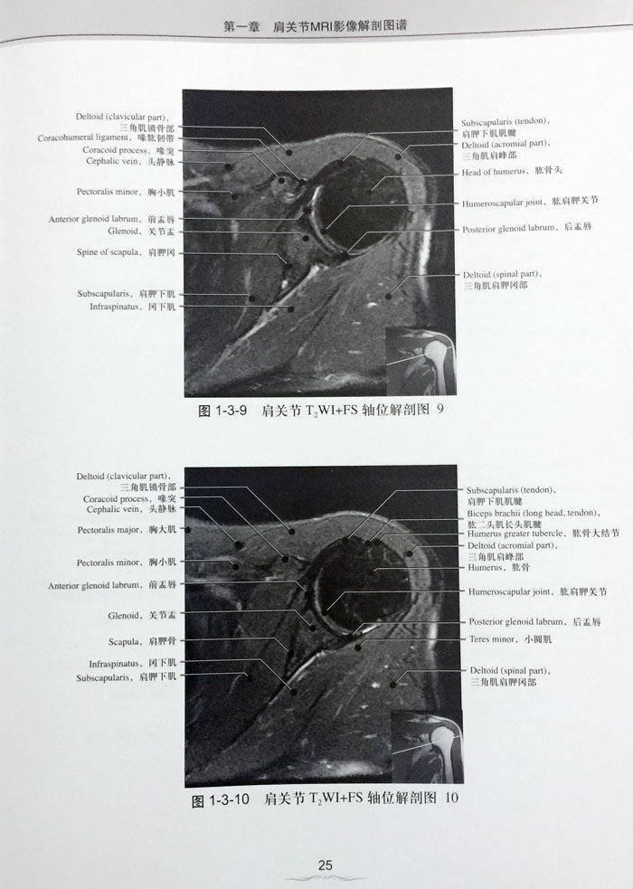 骨关节医学北京大学东坡张东坡晓光磁共振程晓光图谱解剖神经病和精神
