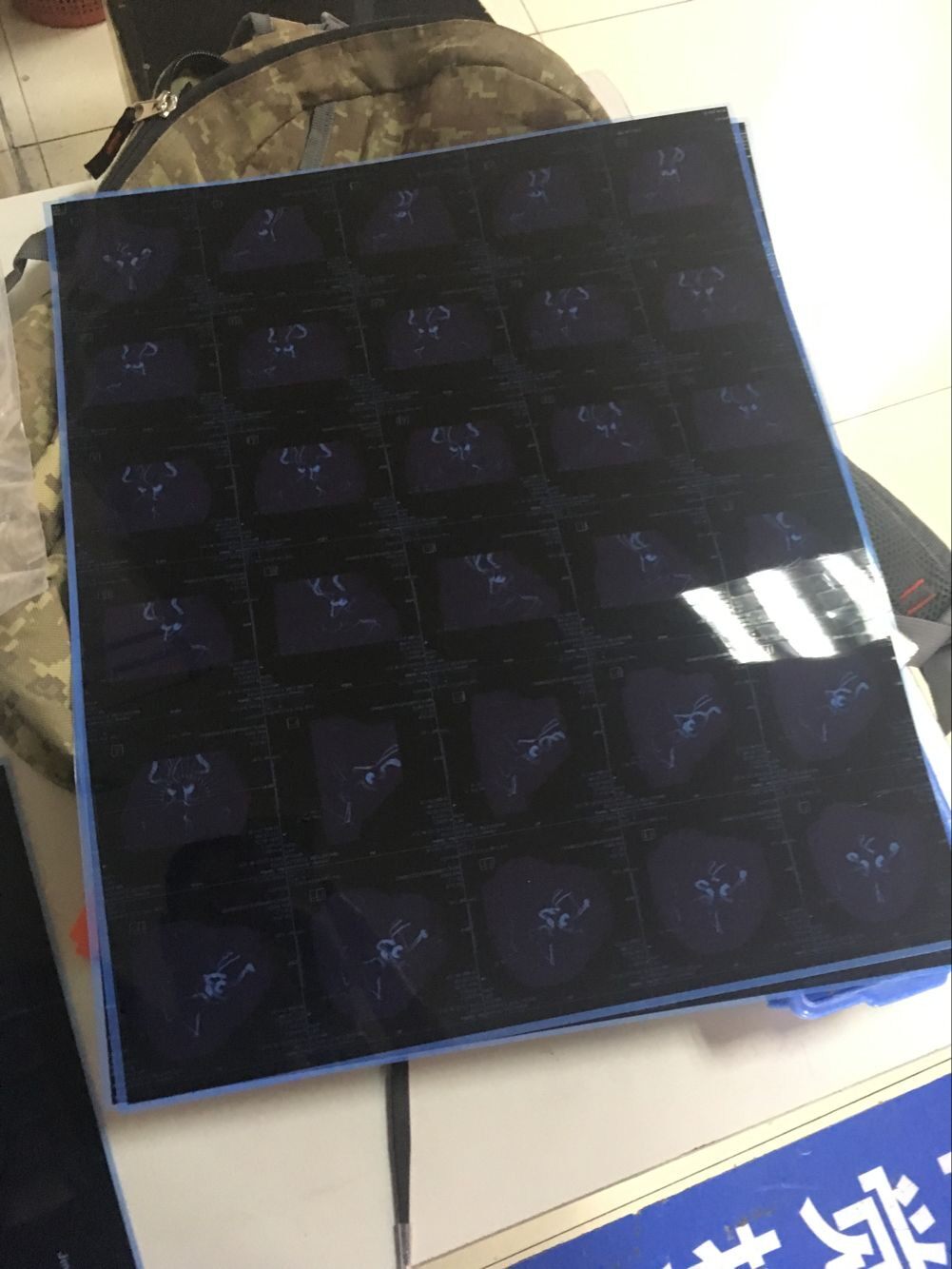 胶片医用干式放射科打印喷墨蓝片牙科骨折drcr透明纸