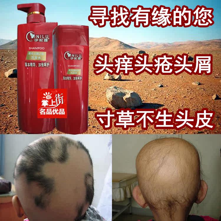 卷发虫头虱子防掉发草本儿童缠发断发螨虫剪发洗发水