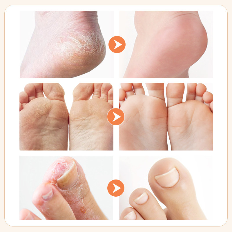 美康粉黛护足霜脚膜防干裂草本足部精华滋润保湿足霜