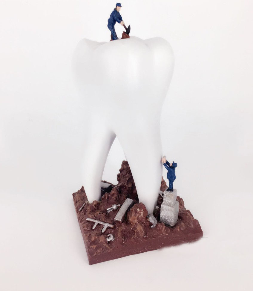 牙科金色大牙牙齿工艺品摆件装饰品开业送礼口腔摆件