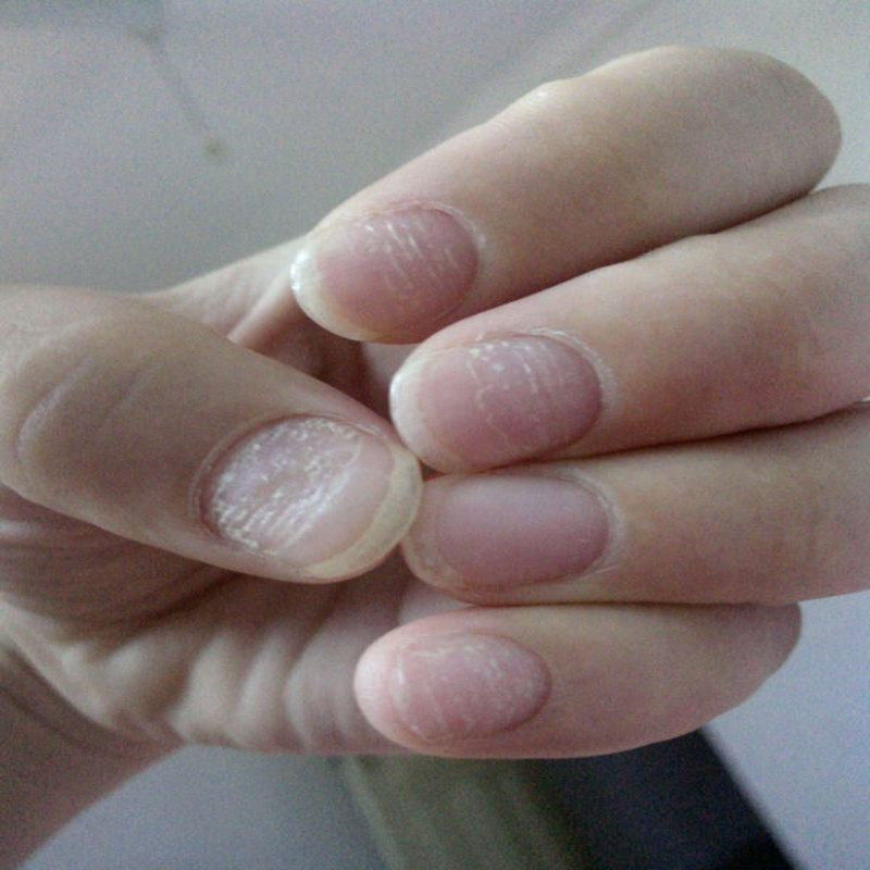 新亮呷灰甲液官正品灰手指甲软甲膏脚趾甲增厚美甲工具