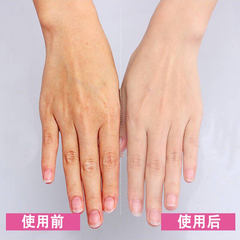 淡化皮嫩去死滋润保湿嫩白手膜手皱纹黄皱纹告别手膜
