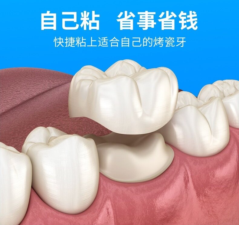 粘烤瓷牙胶水工具修补黏合剂脱落固定牙齿粘固其它口腔护理设备