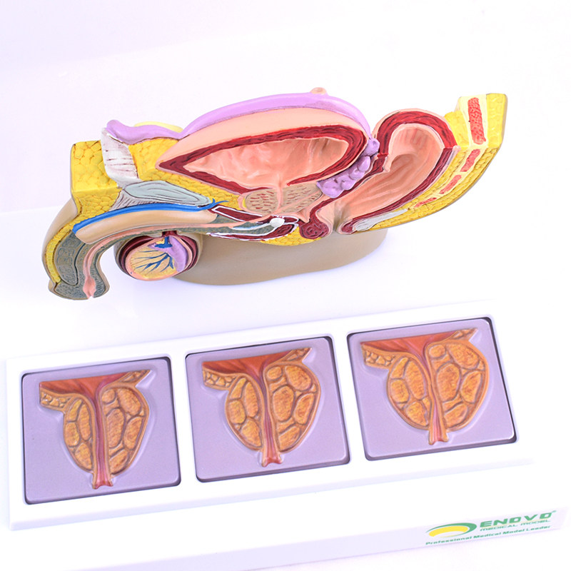 模型男性前列腺enovo男科保健医保健健康教育疾病中老年教学仪器