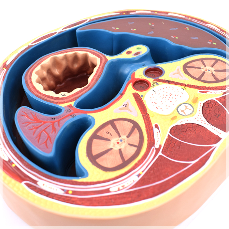 网膜enovo影像医学培训医生系统学影像学磁共振放射教学仪器