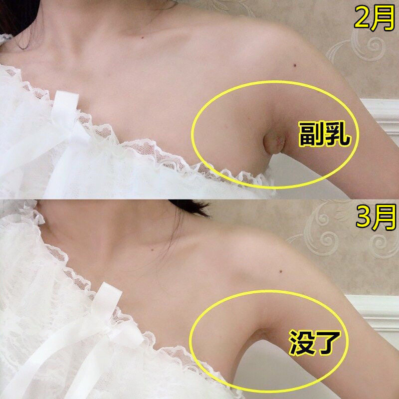 10袋神器腋下颈部腋窝贴收副保健通络淋巴康行护膝