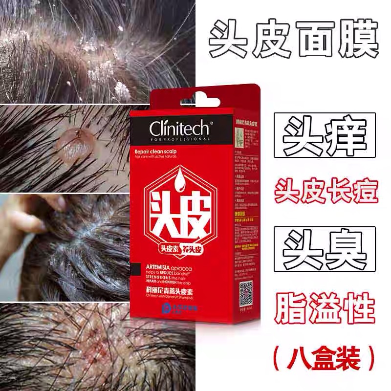 科丽尼青蒿头皮素去屑止痒洗发水128ml头皮癣洗发水男女通用