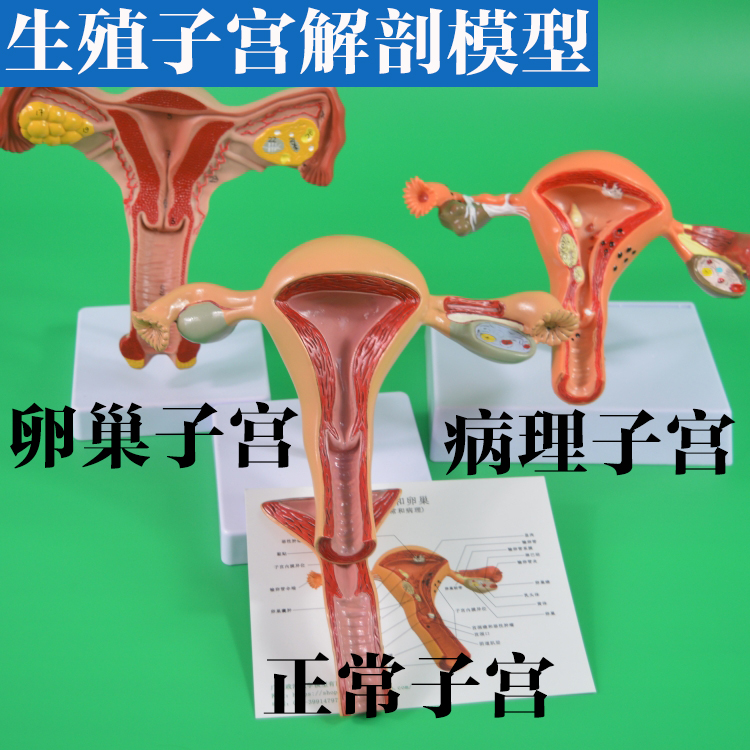 女性子宫 实物图片