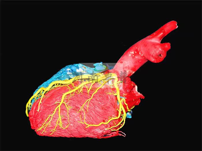 禽畜动物心脏 心基部大血管 心室壁 心外形 心血管 解剖铸型标本