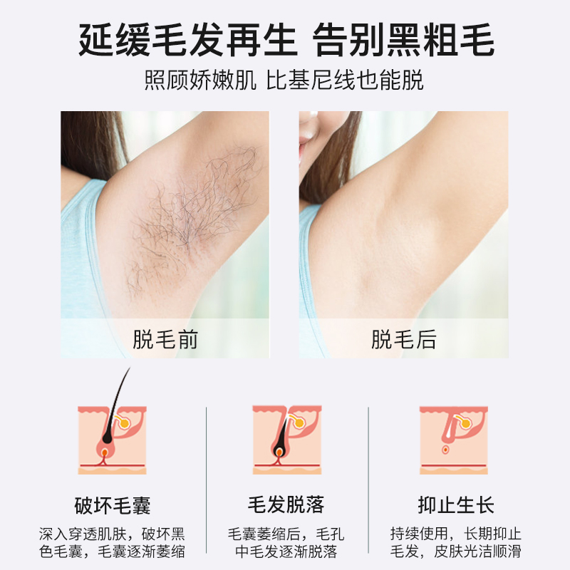 爱满分激光脱毛仪器脱毛神器