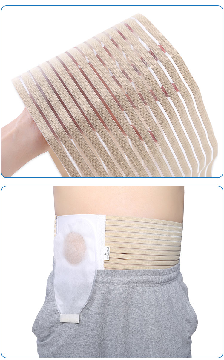 亨德利一次性口袋医用腰带加固固定器一件式肛门造瘘袋造口袋