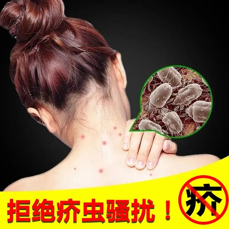 疥疮阴囊结节一扫光疥虫阴虱螨虫外用皮肤瘙痒动物保健品