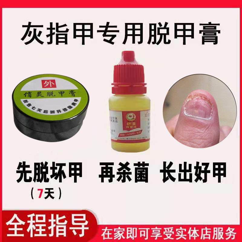 俏灵脱甲膏灰指甲软甲膏亮日增厚本脱甲精油去灰指甲专用药液杀菌