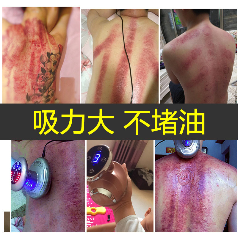 经络刮痧全身家用电动多功能充电火罐美容院专用其它按摩器材