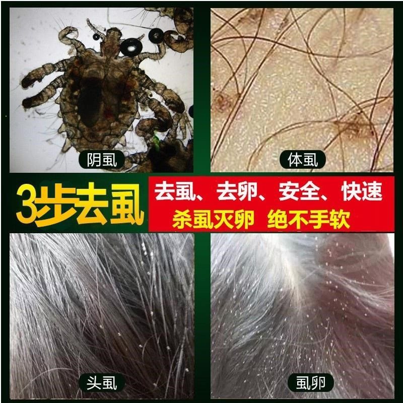 阴虱治湿无踪虱露综药克蚤净必得喷剂家济剂虱通杀虫剂卫生农药