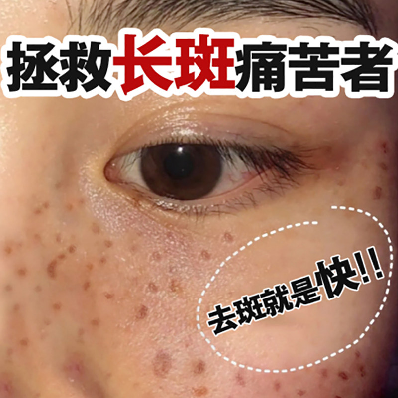 同仁堂祛斑产品旗舰店官网正品去斑美白黄褐斑雀斑乳液