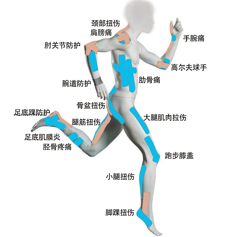 肌肉贴使用方法图示图片