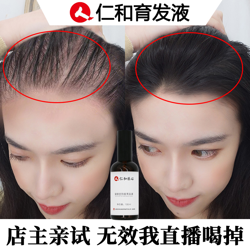 金星推荐仁和育发喷雾头发自然生长速度变密旅行装