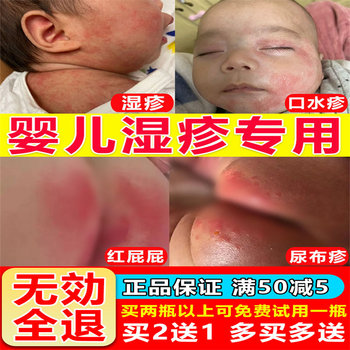 Miao Caofu Wang Yingbao eczema cream saliva rash prickly heat red spots flooded neck butt red itchy Children ຄີມບໍາລຸງຜິວຫນ້າ