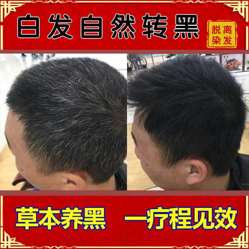 正品何首乌白头发变黑黑发洗发洗发水水草本纯植物洗发水