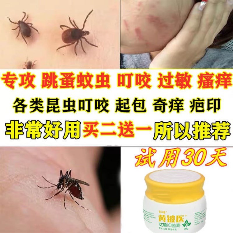 大人儿童蚊虫叮咬药膏止痒消包过敏臭虫跳蚤皮肤消毒护理(消)
