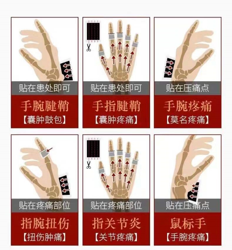 大拇指局部麻醉示意图图片