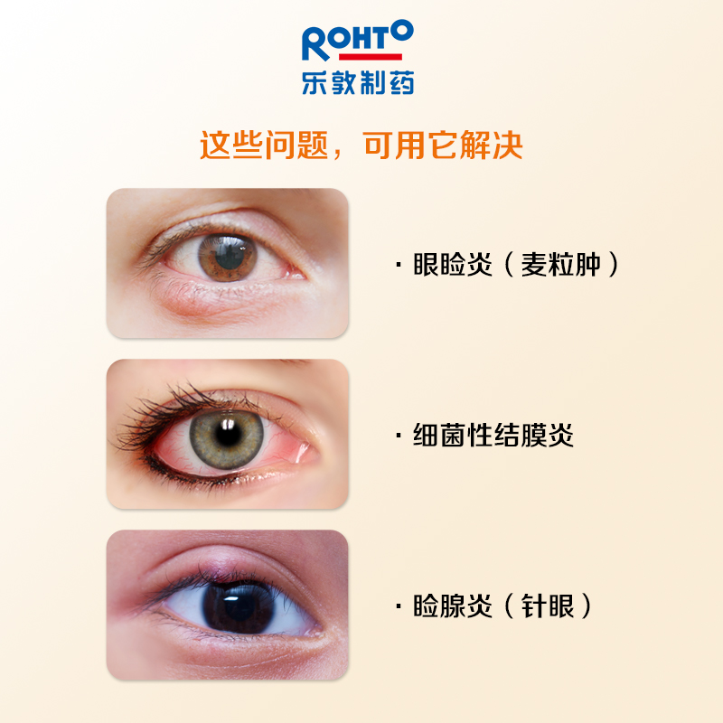 rohto乐敦制药抗菌眼药水ex结膜炎眼痒眼睑炎滴国际五官用药