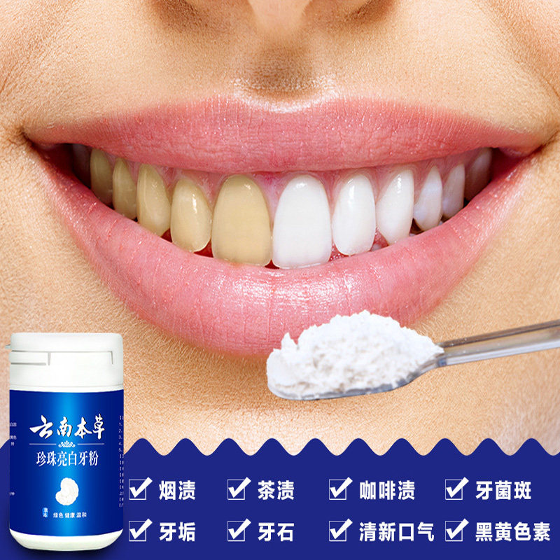 云南本草洗牙粉牙齿美白去黄牙渍垢烟渍茶牙结石除口臭牙斑洁牙粉