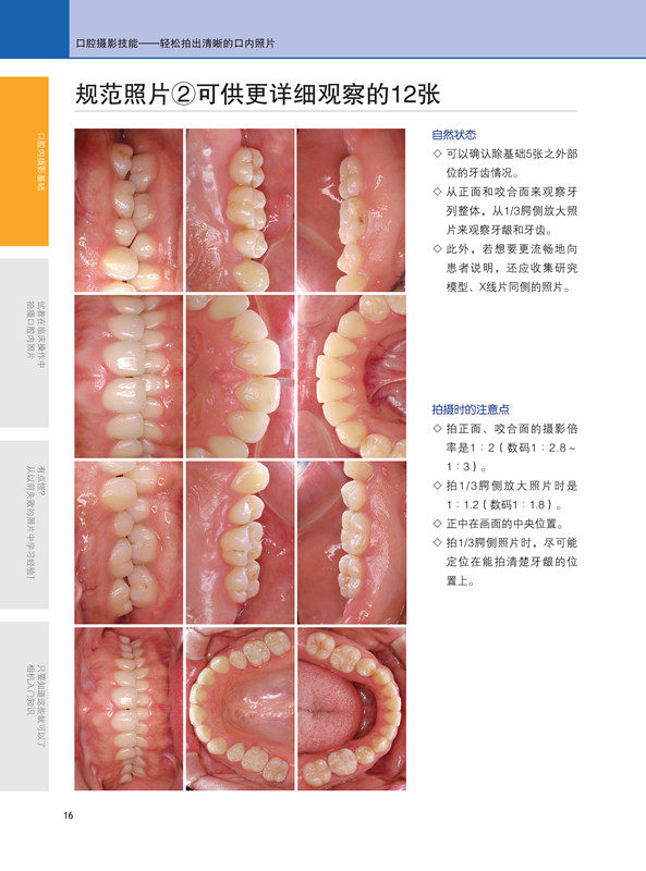正版 包邮 口腔摄影技能 口腔内照片拍摄规范书籍 照相器材患者体位