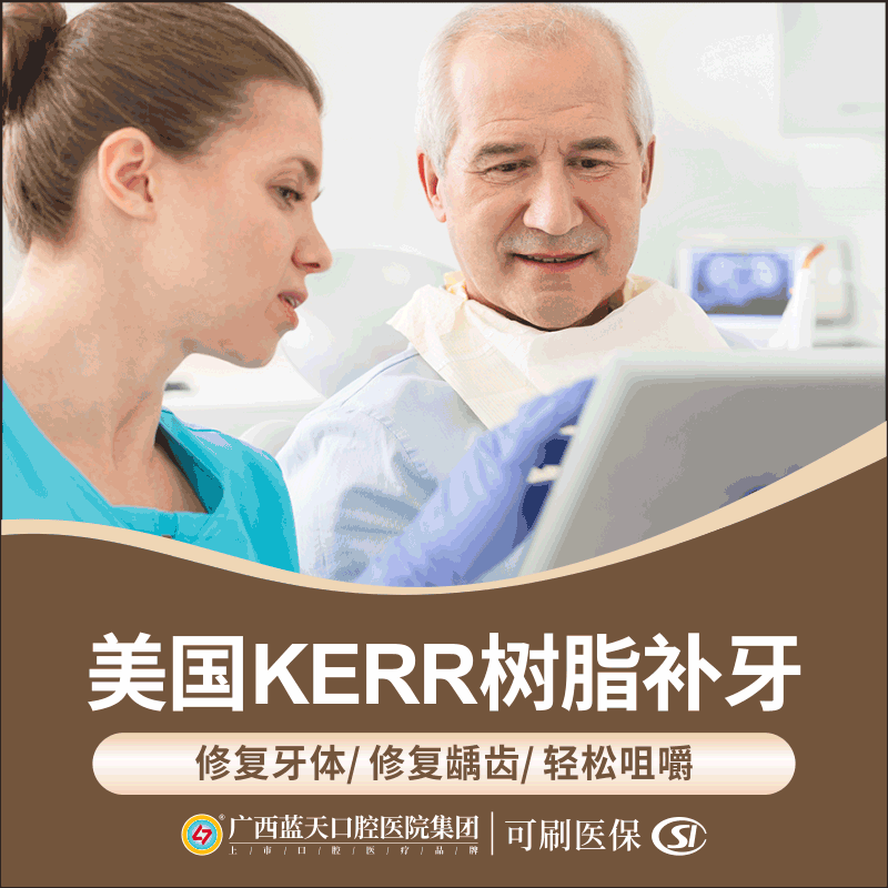 广西蓝天口腔医院美国进口kerr树脂补牙牙虫蛀牙补牙