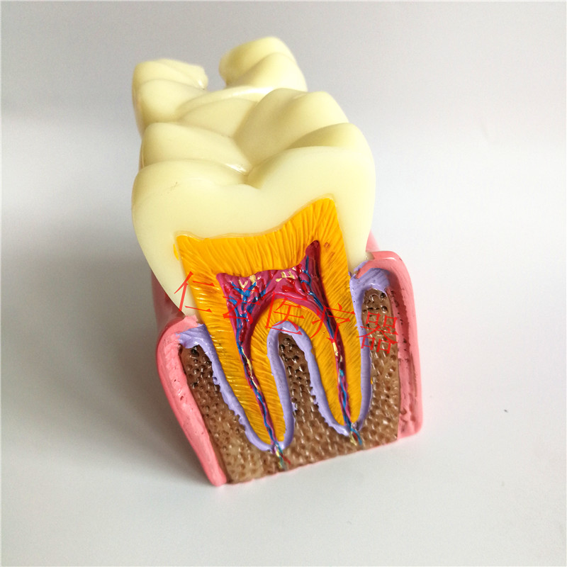 模型牙科6倍龋齿对比口腔医患沟通教学牙齿其它口腔护理设备