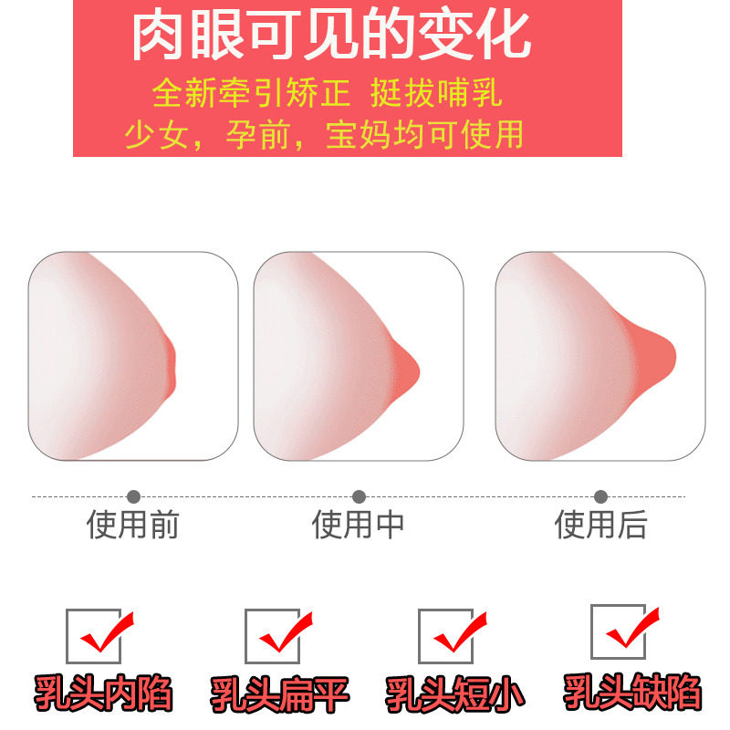牵拉乳头内陷矫正少女凹陷牵引器学生孕产妇喂奶乳头矫正