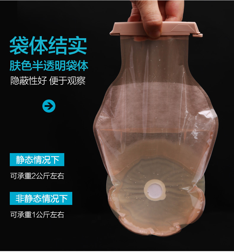 结肠口袋防漏造瘘袋粪袋直肠癌改道大便造口袋