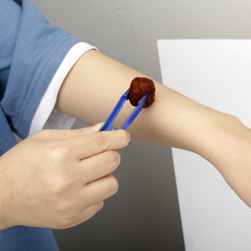 镊子100只医用一次性塑料医疗独立包装防静电尖头镊子