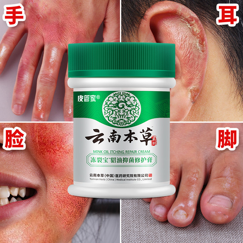 冻疮膏脚后跟干裂消肿止痒冻伤膏冻手防冻防裂手部冬季护手霜女男