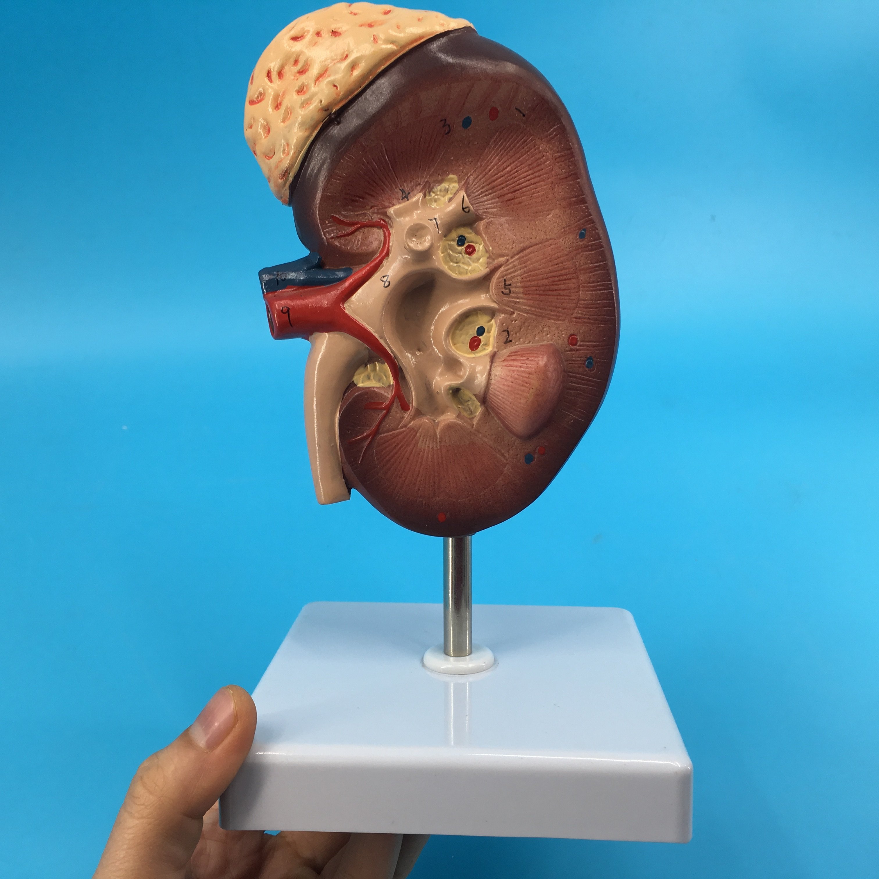 模型放大肾脏二倍人体泌尿泌尿系系统其他模型玩具